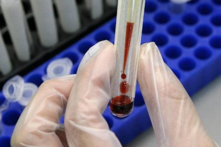 Combatir el cáncer en la sangre es posible gracias a la tecnología vasca